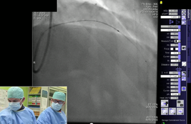 Snímek z videa přímého přenosu operace.