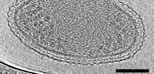 Nejmenší bakterie na světě. Měřítko představuje sto nanometrů (miliardtin metru).