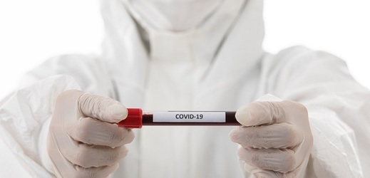 Denní přírůstek koronaviru v Česku podruhé přesáhl 500 osob.